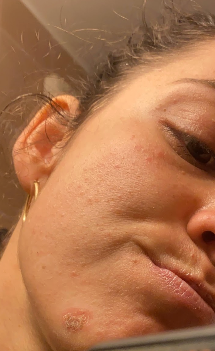 Close-up of a woman's cheek and ear